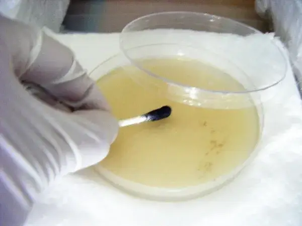 Magic Mushroom Spore Swabs for Agar Plates – Buy in the UK with Fast Shipping Magic Mushroom Spore Swabs for Agar Plates – Buy in the UK with Fast Shipping