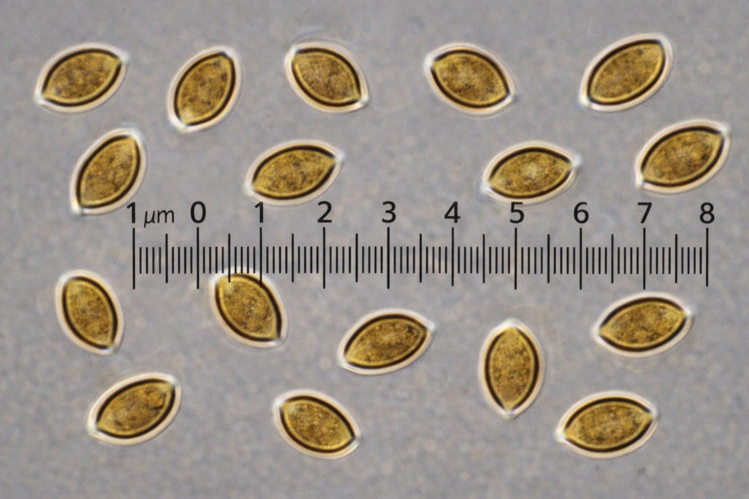 mushroom spores under magnification in mycology microscopy