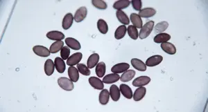 High-magnification microscopy photograph of Psilocybe cubensis fungal spores on a glass slide, as seen through a compound laboratory microscope.