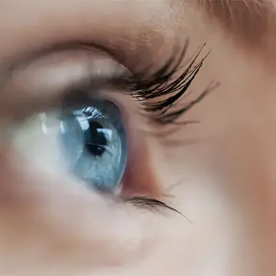 Increased amygdala responses